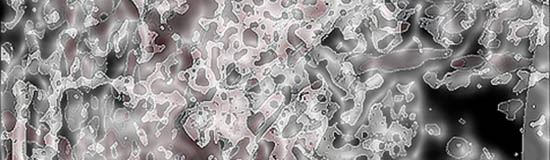 [Création] Daniel Cabanis, Pas dans la dentelle, saynètes (4/6)