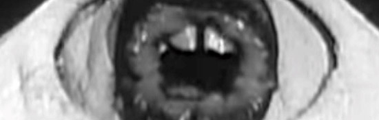 [TEXTE] JPP, Une navrant-garde : LE FORMOLISME  (Manifeste Verheggen)